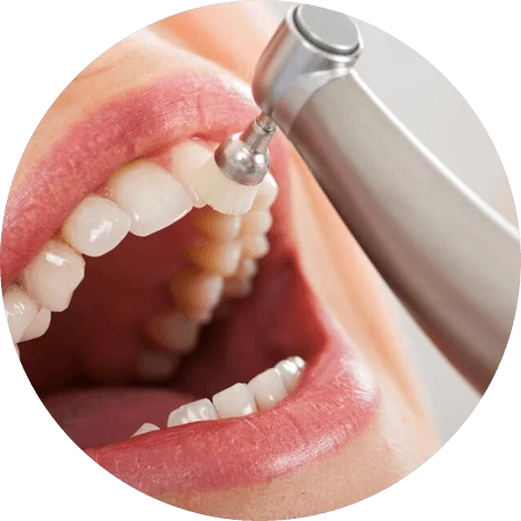 Баннер Чистка зубов Баннер Чистка зубов