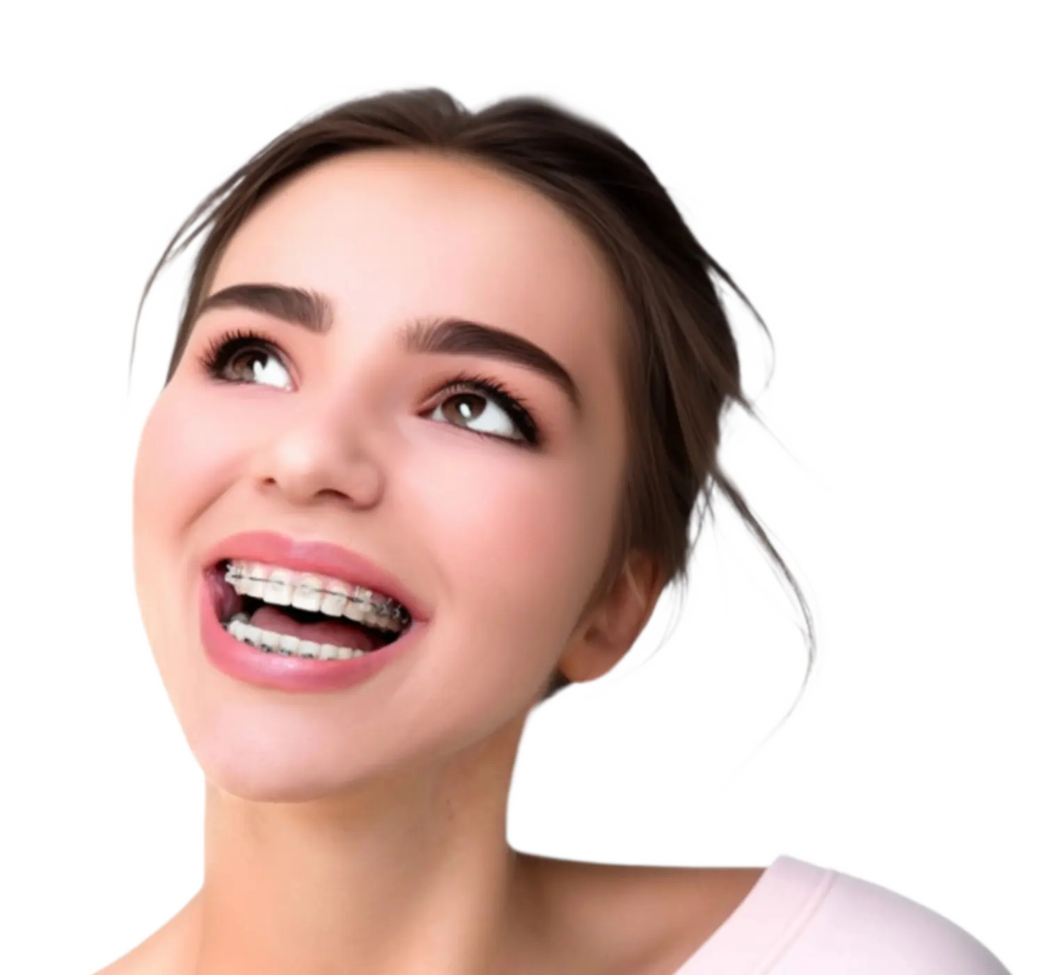 Баннер Брекеты Damon Баннер Брекеты Damon