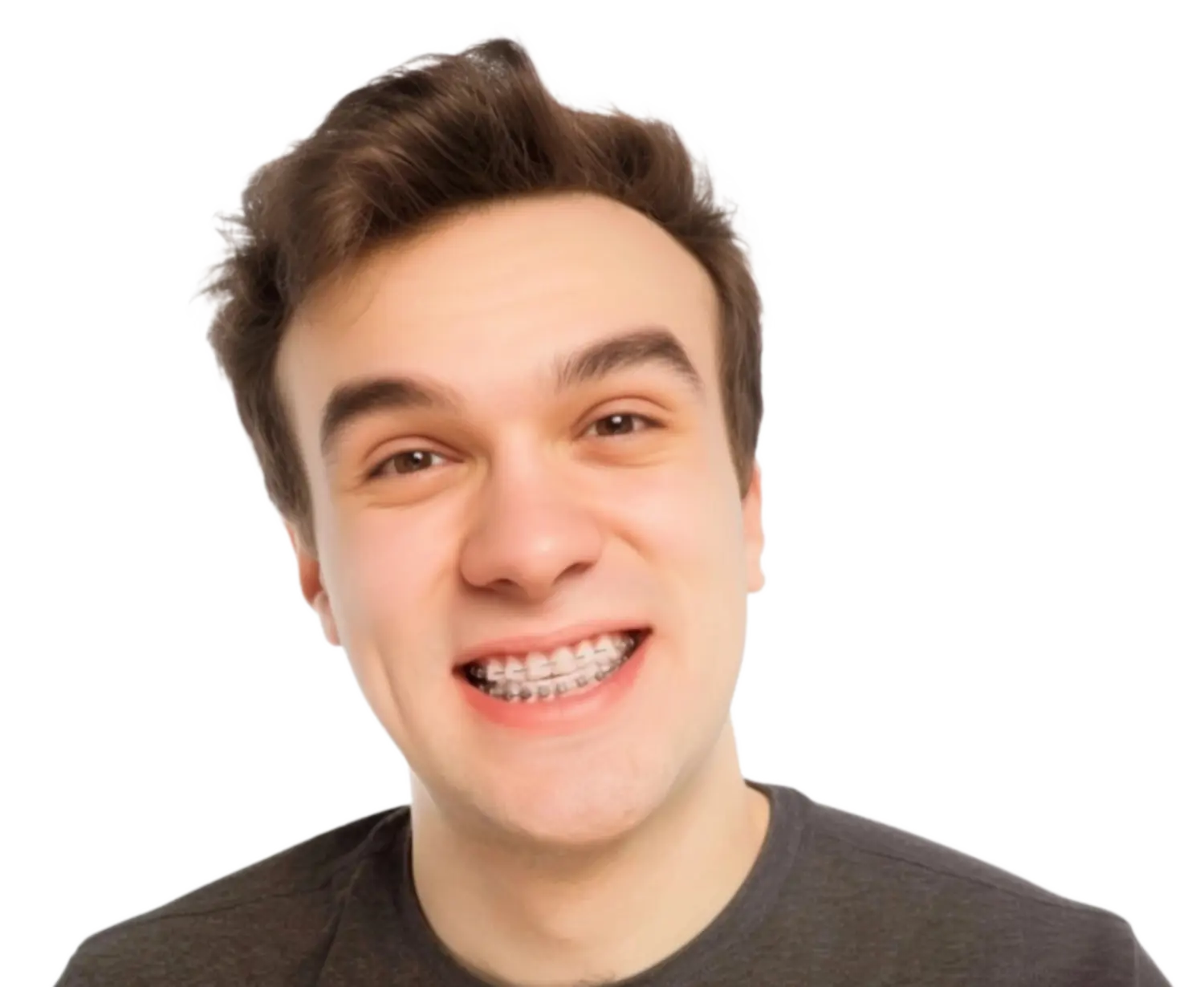 Баннер Комбинированные брекеты Баннер Комбинированные брекеты